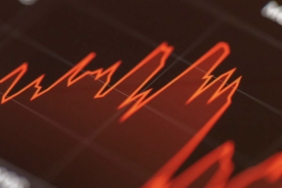 Bitcoin sert dalgalanmalar yaşarken bu altcoinlere dikkat!